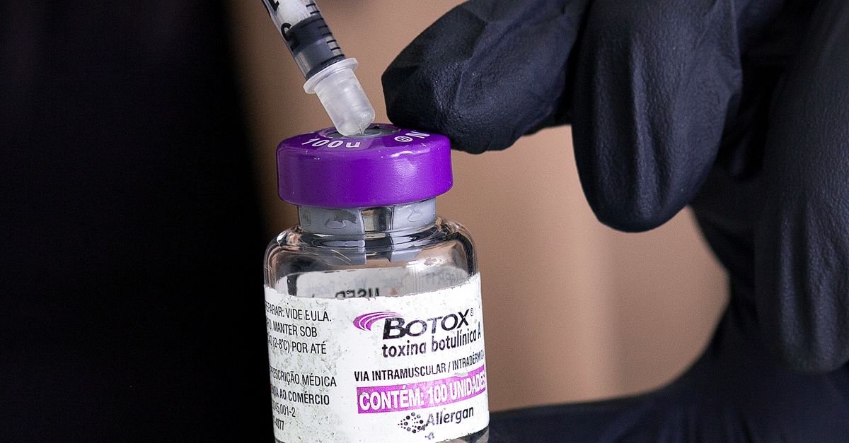 How Long Do Dermal Fillers Last? An Overview