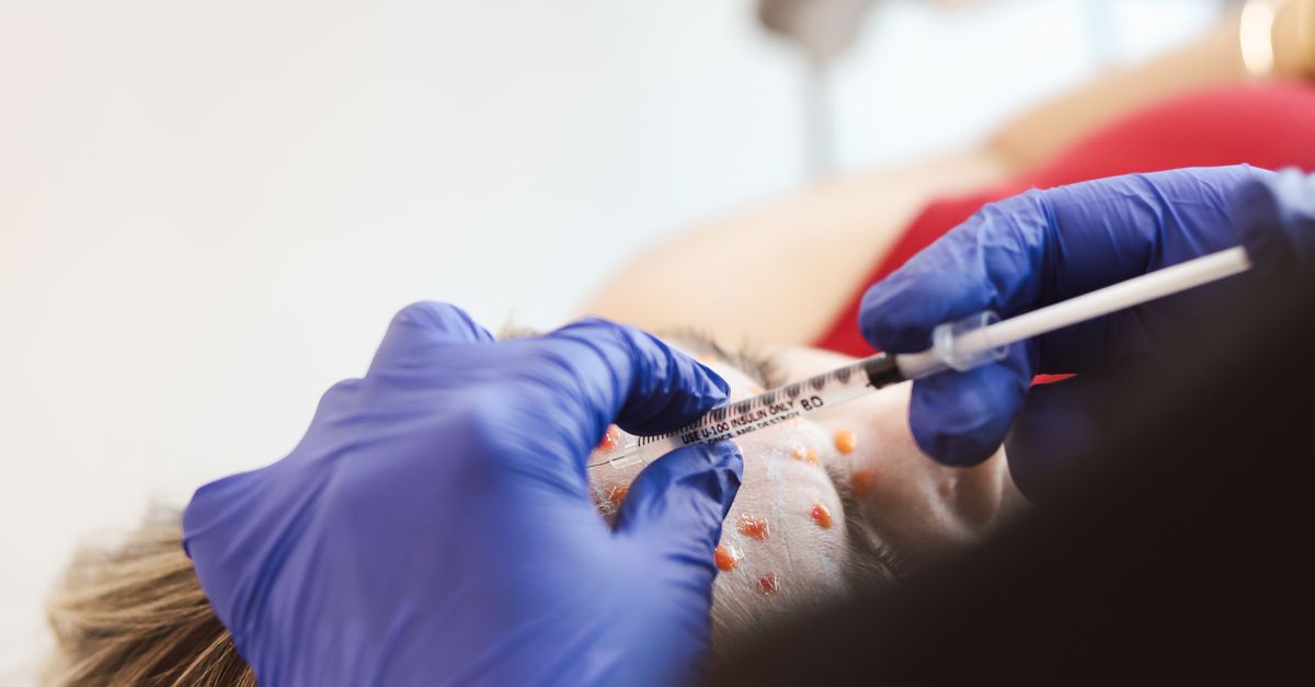 How to Choose the Right Dermal Filler for Your Needs